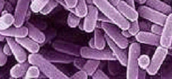 Bifidobacterium longum